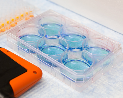 clear tray on a table with six petri dishes filled with liquid