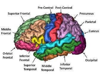 Structural MRI image