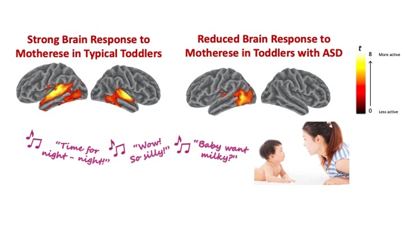Brain Response to Motherese
