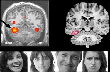 images of a brain responding to facial expressions