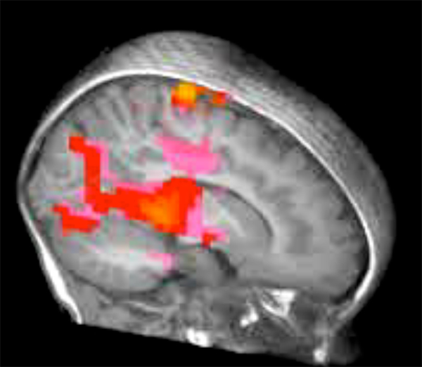 Fmri Scans Brain