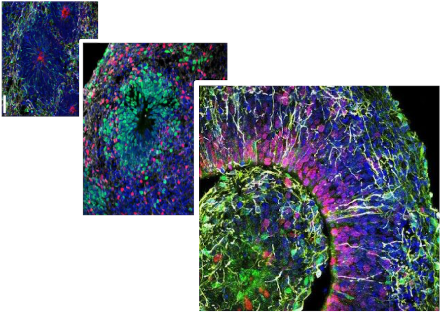 https://neurosciences.ucsd.edu/centers-programs/autism/_images/research/stem-cell-combined.png