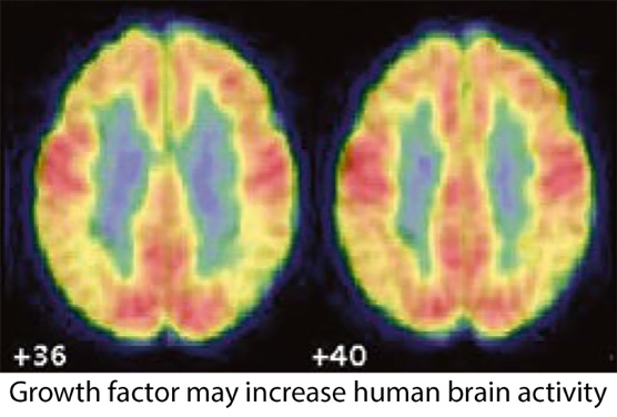 color mri of two brains showing growth factor may increase human brain activity