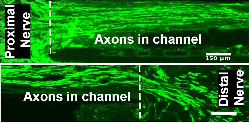 Scaffolds with strictly linear internal architecture successfully guide and enhance axonal regeneration into and beyond sites of peripheral nerve injury