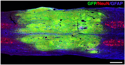 Excellent survival, integration and maturation of grafted neural progenitor cells (NPCs) in a rat T10 moderate contusive injury site