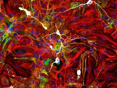 neuronal differentiation mri