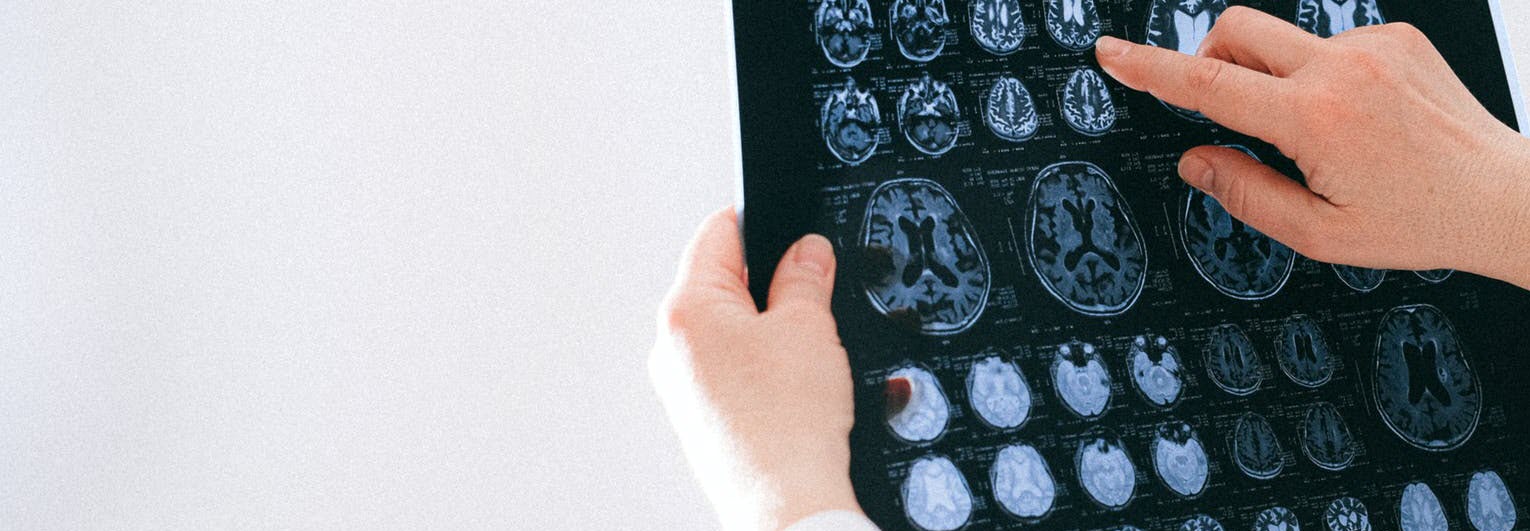 radiologist reviewing mri images 