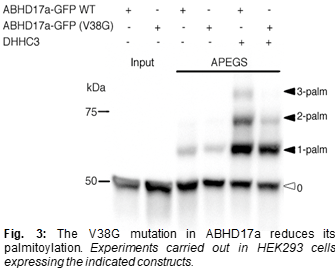 The V38G mutation in ABHD17a reduces its palmitoylation. Experiments carried out in HEK293 cells expressing the indicated constructs