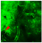 biomarkers 