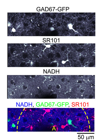 in vivo 2-photon imaging graphic