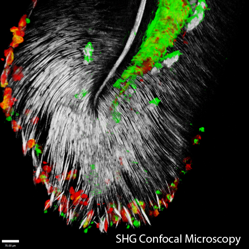SHG Confocal Microscopy